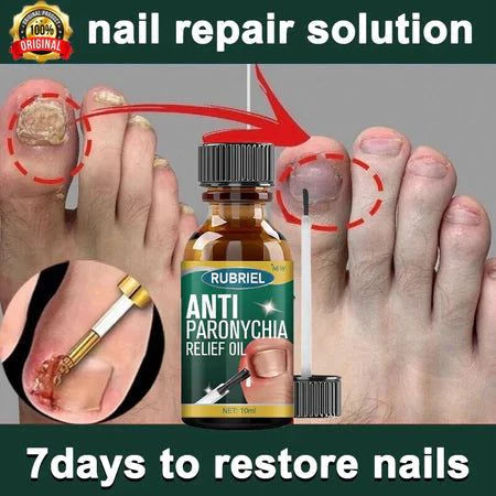 Anti Paronychia Relief Oil: Buy 1 Get 1 Free!